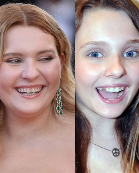 abigail breslin teeth|The Stunning Transformation Of Abigail Breslin